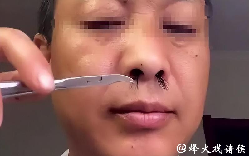 鼻毛“窜”出来的男人, 有何不同? 鼻毛变白暗示什么? 一文说清楚 鼻毛“窜”出来的男人, 有何不同? 鼻毛变白暗示什么? 一文说清楚